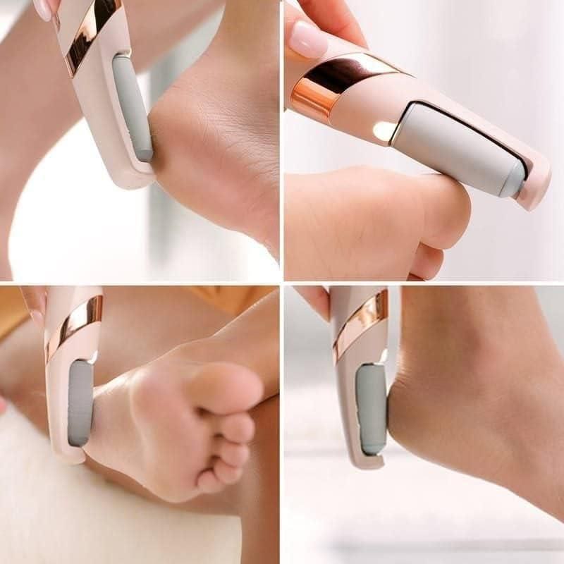 Electronic Cordless Pedicure Callus Remover – Smooth, Soft Feet Effortlessly!